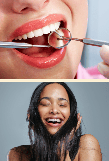 Best Smile Design Clinic In Pimple Saudagar, Sangavi, Baner, Balewadi,  Wakad & Nearby Areas