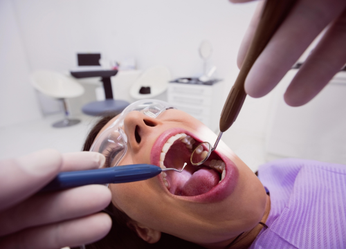 Dental Implants Treatment In Pimple Saudagar, Sangavi, Wakad, Baner, Balewadi